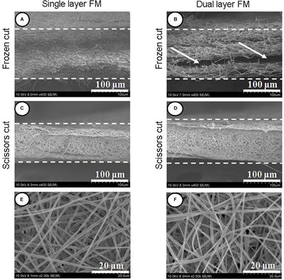 An Integrative Dual-Layer Poly-L-Lactic Acid Fibrous Membrane Prevents Peritendinous Adhesions